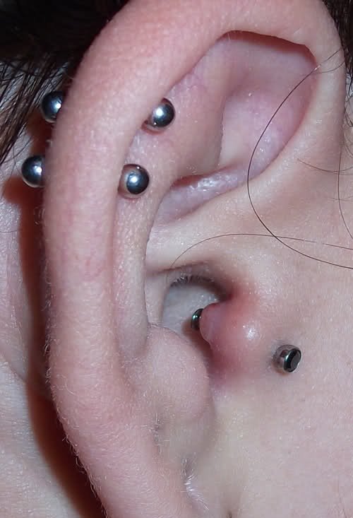infected tragus piercing bubble